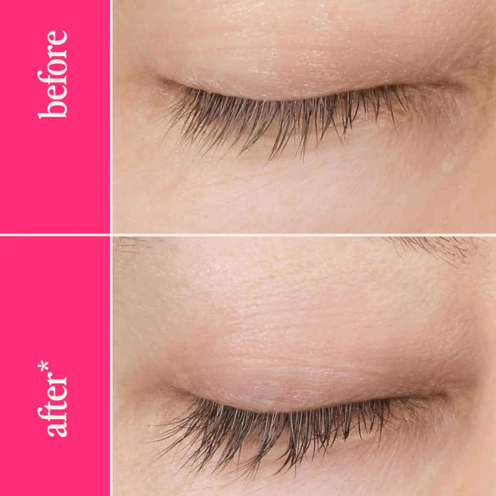 LashMD - Image 2