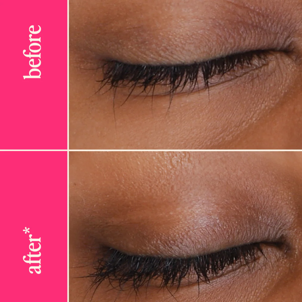 LashMD - Image 5